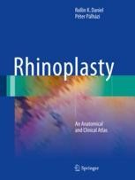 Rhinoplasty: An Anatomical and Clinical Atlas | SpringerLink