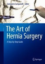 The Art of Hernia Surgery: A Step-by-Step Guide | Springer Nature Link