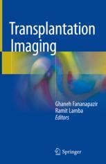 Liver Transplant Interventions | SpringerLink