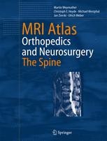 MRI Atlas: Orthopedics and Neurosurgery, The Spine | Springer