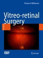 Vitreoretinal Surgery | SpringerLink Vitreoretinal Surgery | SpringerLink