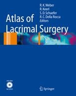 Atlas of Lacrimal Surgery | SpringerLink