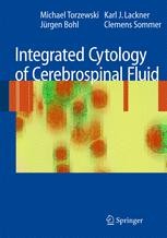 Integrated Cytology of Cerebrospinal Fluid | Springer Nature Link