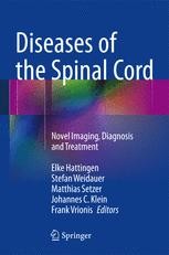 脊椎脊髄病学 = PRINCIPLES OF SPINAL DISORDERS Spinal Disorders: Fundamentals of Diagnosis and Treatment