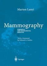 Mammography: Diagnosis and Pathological Analysis | Springer Nature Link