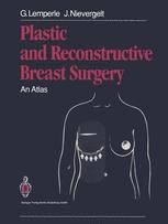 健康・医学 Atlas of Breast Surgical Techniques Atlas of Breast Surgery | SpringerLink