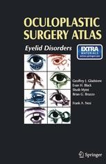 Oculoplastic Surgery Atlas: Eyelid Disorders | SpringerLink