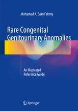 Urethral Anomalies | Springer Nature Link
