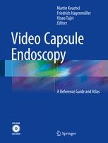 Spiral Enteroscopy and Balloon-Guided Enteroscopy | Springer Nature Link