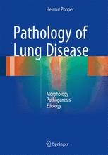 Lung Tumors | Springer Nature Link