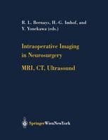 Intraoperative Imaging in Neurosurgery: MRI, CT, Ultrasound | Springer ...