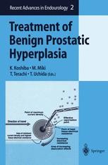Treatment of Benign Prostatic Hyperplasia (Recent Advances in Endourology， 2) [ハードカバー] Koshiba， K.? Miki， M.? Terachi， T.; Uchida， T.
