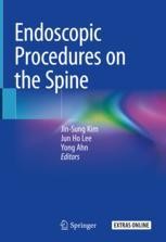 Endoscopic Procedures on the Spine | Springer Nature Link