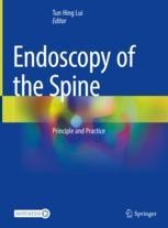 Endoscopy of the Spine: Principle and Practice | Springer Nature Link