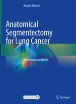 Amazon.com: Anatomical Segmentectomy for Lung Cancer 【Right