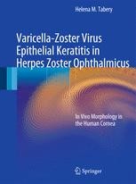 Varicella Zoster Virus Epithelial Keratitis In Herpes Zoster Ophthalmicus In Vivo Morphology In The Human Cornea Helena M Tabery Springer