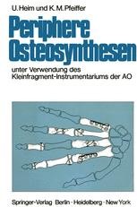 Periphere Osteosynthesen Unter Verwendung Des Kleinfragment Instrumentariums Der Ao Urs Heim Springer