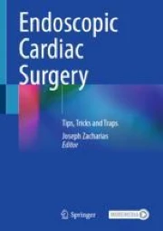 Endoscopic Cardiac Surgery: Tips, Tricks and Traps | Springer Nature Link