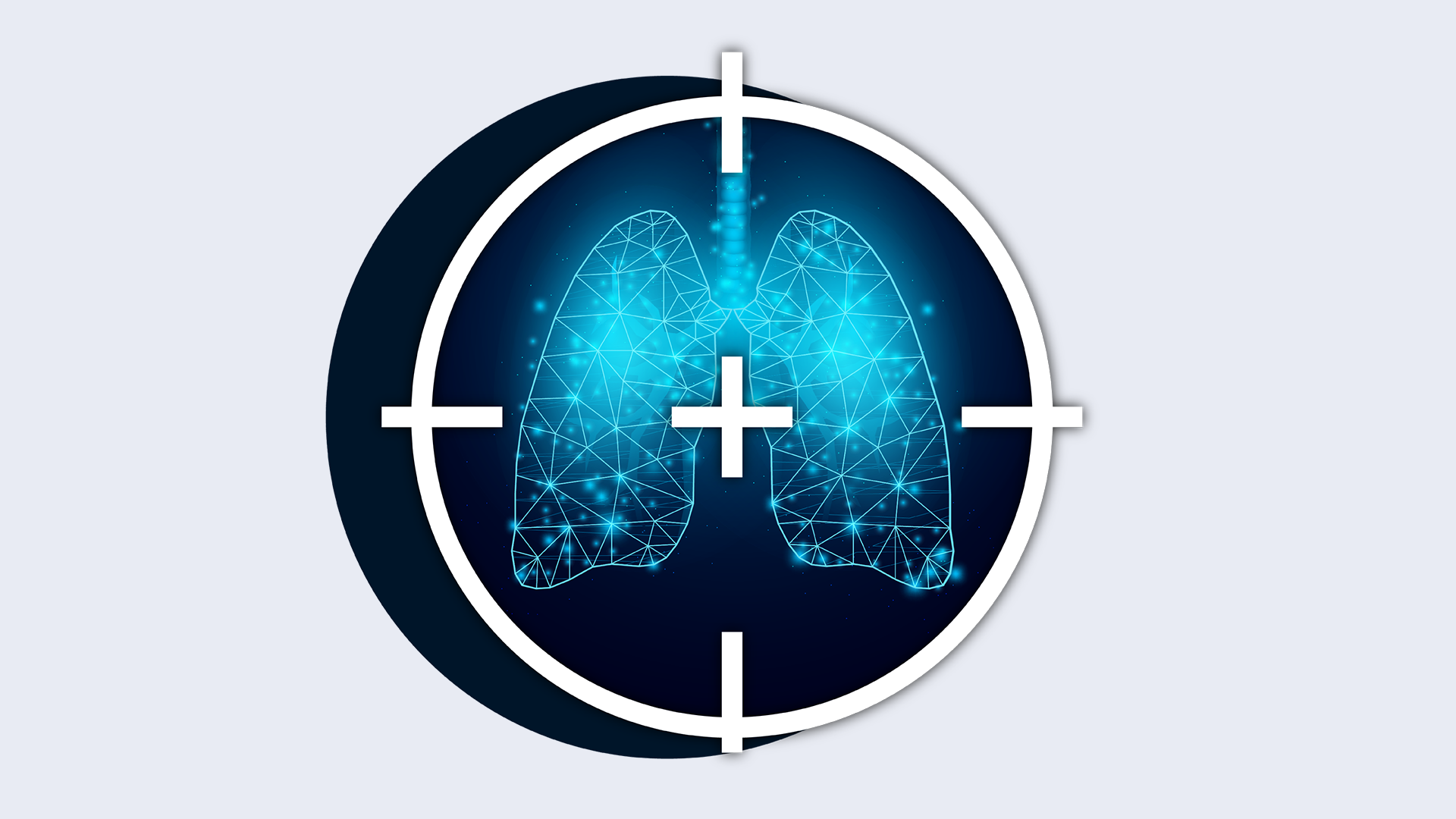 Biomarker-driven management of NSCLC