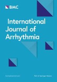 Effect of carvedilol on premature ventricular complexes originating from the ventricular outflow tract - International Journal of Arrhythmia