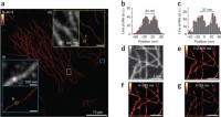 Unbiased, fast SMSN of fixed microtubules, demonstrating high-throughput capabilities.