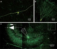 Morphological criteria for unequivocal identification of hippocampal mossy fiber boutons.