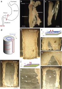 Illustrated dissection procedure.