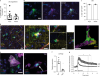 Integration of iAs into mouse brain, and modeling of Alexander disease with CRISPR and iAs.