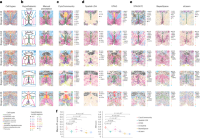Performance evaluation of the unsupervised CytoCommunity algorithm using single-cell spatial transcriptomics data.
