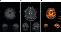 Example MRI data for subject_0 used for head model construction and field modeling.