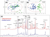 Comparative (a) PCA, (b) OPLS-DA scatter plots, and (c) Assigned 1H NMR spectra of urine samples from colorectal cancer (CRC) patients and healthy control (HC) samples.