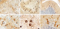 Examples of immunohistochemistry of normal CNS cells.