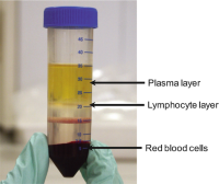 Isolation of peripheral blood mononuclear cells (PBMC) from venous whole blood.