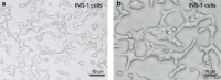 Characteristic morphology of cultured INS-1INS-1 cells as seen at low (a) and high magnification (b)