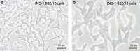 Characteristic morphology of cultured INS-1 832/13INS-1 832/13 cells as seen at low (a) and high magnification (b)