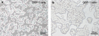 Characteristic morphology of cultured QGP-1 cells as seen at low (a) and high magnification (b)