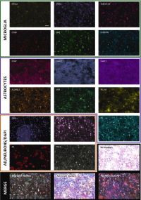 Example of cyclic multiplexMultiplex fluorescent immunohistochemistryImmunohistochemistry (IHC) from a cortical ROI.