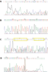 Typical images of a sequence as shown in Chromas™ lite.