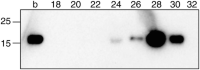 Detection of LTA in FPLC fractions by western blotWestern-blot .