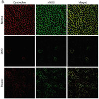 ImmunofluorescenceImmunofluorescence stainingStaining for dystrophin and nNOS.