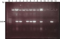 Gel electrophoresis of amplified plasmid DNA samples from HIV-infected patients.