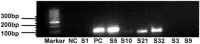 Gel image of rhinovirus nested-RT-PCR products.