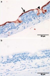 Protein histochemistry for IBV M41-S1.