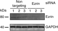Assessment of ezrin protein expression knockdown induced by siRNA transfections.