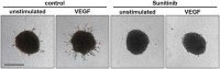 VEGF induces sproutingSprouting in HUVEC spheroids.