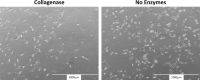 The ADSCs Adipose derived stem cells (ADSCs) isolated by collagenase treatment (left panel) yield a longer, narrower morphology as compared to the traditional spindle shape seen in the nonenzymatic isolationIsolation treatment (right panel)