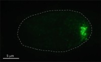 Live-cell imaging of Xist-Bgl RNA coating an autosome.