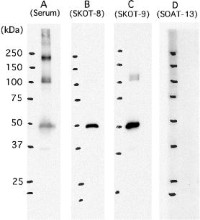 Immunoblot of SARS-CoV proteins with monoclonal antibodies.