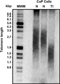 Determination of telomere length in prostate cancer cells (LNCaP) with or without the treatment of a telomerase inhibitor for 3 days.