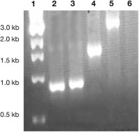 PCR amplification of the recombinant bacmid DNA.